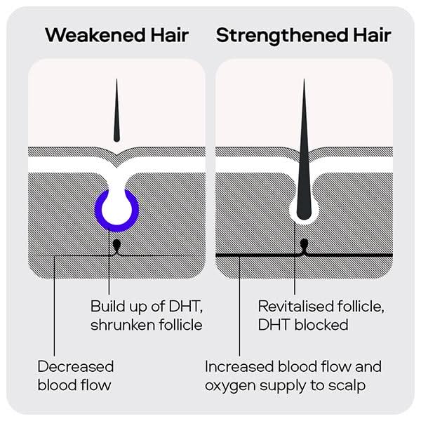 Sons Hair Loss Complete Set - Image 5