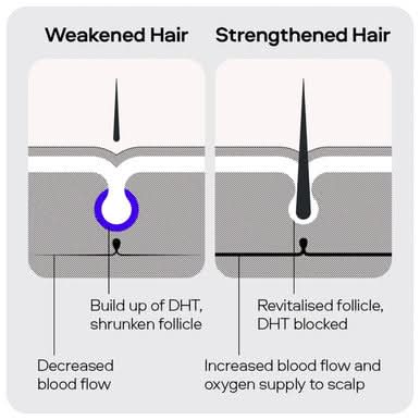 Sons Minoxidil 5% Spray 1 Month - Image 7